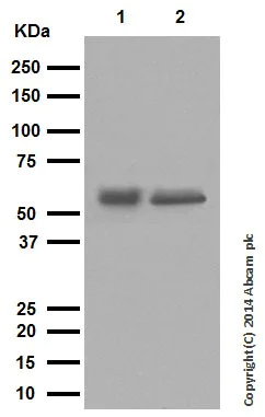 Western blot - Anti-Cytokeratin 10 antibody [EP1607IHCY] - Cytoskeleton Marker (AB76318)