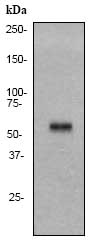 Western blot - Anti-Cytokeratin 10 antibody [EP1607IHCY] - Cytoskeleton Marker (ab76318), expandable thumbnail