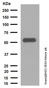 Western blot - Anti-Cytokeratin 10 antibody [EP1607IHCY] - Cytoskeleton Marker (ab76318), expandable thumbnail