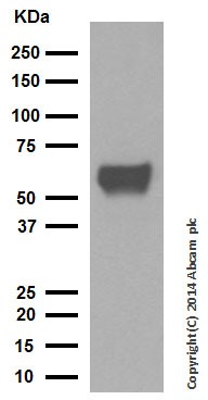 Western blot - Anti-Cytokeratin 10 antibody [EP1607IHCY] - Cytoskeleton Marker (ab76318), expandable thumbnail