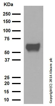 Western blot - Anti-Cytokeratin 10 antibody [EP1607IHCY] - Cytoskeleton Marker (AB76318)