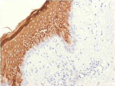 Immunohistochemistry (Formalin/PFA-fixed paraffin-embedded sections) - Anti-Cytokeratin 10 antibody [KRT10/1948R] (AB234313)