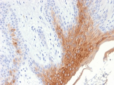 Immunohistochemistry (Formalin/PFA-fixed paraffin-embedded sections) - Anti-Cytokeratin 10 antibody [KRT10/1990R] (AB238014), expandable thumbnail