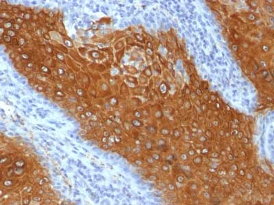 Immunohistochemistry (Formalin/PFA-fixed paraffin-embedded sections) - Anti-Cytokeratin 10 antibody [KRT10/844] (AB218441)