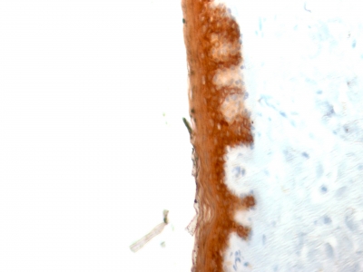 Immunohistochemistry (Formalin/PFA-fixed paraffin-embedded sections) - Anti-Cytokeratin 10 antibody [KRT10/844] - BSA and Azide free (AB212546)