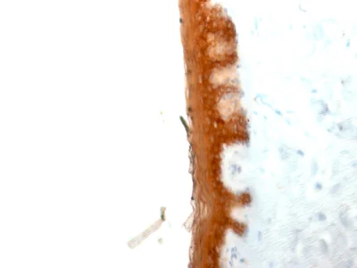 Immunohistochemistry (Formalin/PFA-fixed paraffin-embedded sections) - Anti-Cytokeratin 10 antibody [KRT10/844] - BSA and Azide free (AB212546)