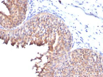 Immunohistochemistry (Formalin/PFA-fixed paraffin-embedded sections) - Anti-Cytokeratin 10 antibody [KRT10/844] - BSA and Azide free (AB212546)