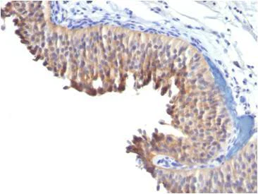 Immunohistochemistry (Formalin/PFA-fixed paraffin-embedded sections) - Anti-Cytokeratin 10 antibody [LH2] (AB20208)