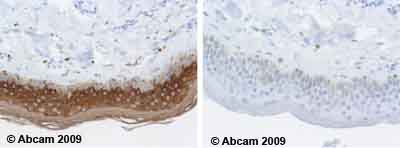Immunohistochemistry (Formalin/PFA-fixed paraffin-embedded sections) - Anti-Cytokeratin 10 antibody [LH2] (AB20208)