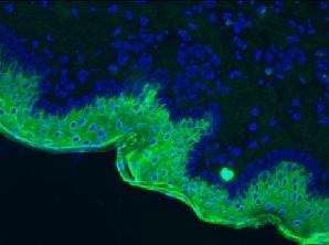 Anti-Cytokeratin 10 antibody [RKSE60]