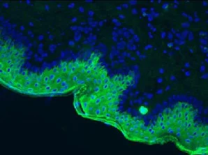 Immunohistochemistry (Frozen sections) - Anti-Cytokeratin 10 antibody [RKSE60] (AB9025)