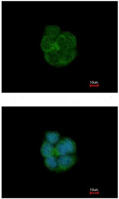 Immunocytochemistry/ Immunofluorescence - Anti-Cytokeratin 13 antibody (AB154346), expandable thumbnail