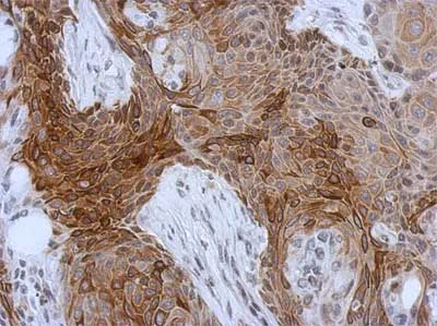 Immunohistochemistry (Formalin/PFA-fixed paraffin-embedded sections) - Anti-Cytokeratin 13 antibody (AB154346)