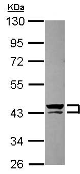 Western blot - Anti-Cytokeratin 13 antibody (AB154346), expandable thumbnail