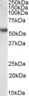 Western blot - Anti-Cytokeratin 13 antibody (AB79279), expandable thumbnail
