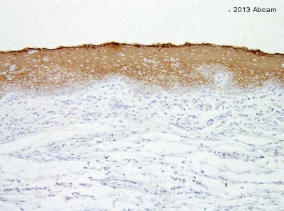 Immunohistochemistry (Formalin/PFA-fixed paraffin-embedded sections) - Anti-Cytokeratin 13 antibody [AE8] (ab16112), expandable thumbnail