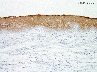 Immunohistochemistry (Formalin/PFA-fixed paraffin-embedded sections) - Anti-Cytokeratin 13 antibody [AE8] (AB16112)