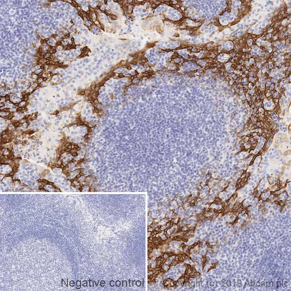 Immunohistochemistry (Formalin/PFA-fixed paraffin-embedded sections) - Anti-Cytokeratin 13 antibody [AE8] (AB16112)