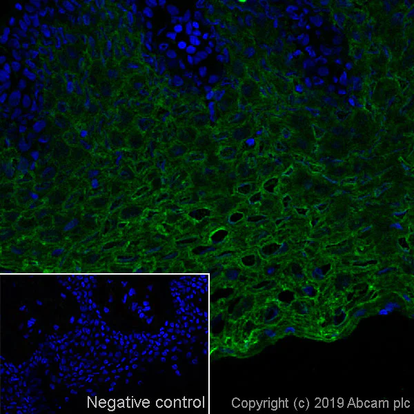 Immunohistochemistry (Frozen sections) - Anti-Cytokeratin 13 antibody [AE8] (AB16112)