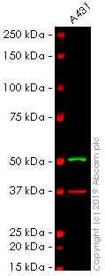 Western blot - Anti-Cytokeratin 13 antibody [AE8] (AB16112)