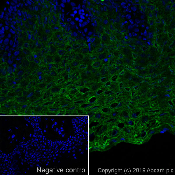 Immunohistochemistry (Frozen sections) - Anti-Cytokeratin 13 antibody [AE8] - BSA and Azide free (AB269574), expandable thumbnail