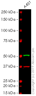 Western blot - Anti-Cytokeratin 13 antibody [AE8] - BSA and Azide free (AB269574), expandable thumbnail