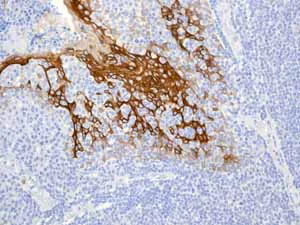 Immunohistochemistry (Formalin/PFA-fixed paraffin-embedded sections) - Anti-Cytokeratin 13 antibody [EPR3671] (AB92551)