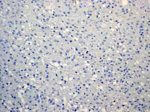 Immunohistochemistry (Formalin/PFA-fixed paraffin-embedded sections) - Anti-Cytokeratin 13 antibody [EPR3671] (AB92551)