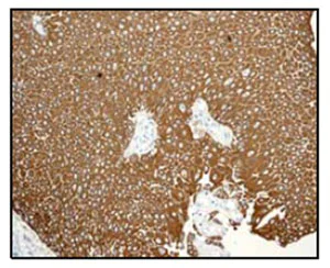 Immunohistochemistry (Formalin/PFA-fixed paraffin-embedded sections) - Anti-Cytokeratin 13 antibody [EPR3671] (AB92551)