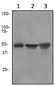 Western blot - Anti-Cytokeratin 13 antibody [EPR3671] (AB92551)