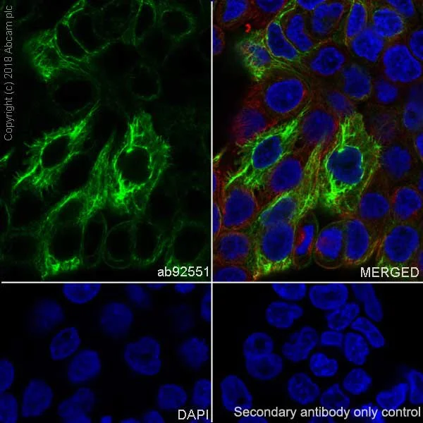 Immunocytochemistry/ Immunofluorescence - Anti-Cytokeratin 13 antibody [EPR3671] - BSA and Azide free (AB239918)