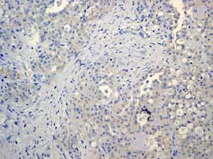 Immunohistochemistry (Formalin/PFA-fixed paraffin-embedded sections) - Anti-Cytokeratin 13 antibody [EPR3671] - BSA and Azide free (AB239918)