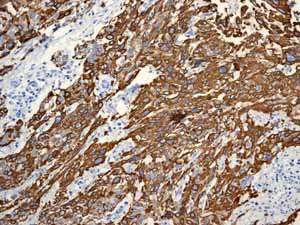 Immunohistochemistry (Formalin/PFA-fixed paraffin-embedded sections) - Anti-Cytokeratin 13 antibody [EPR3671] - BSA and Azide free (AB239918)