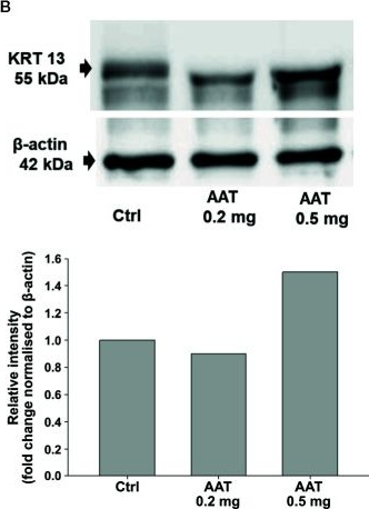 Western blot - Anti-Cytokeratin 13 antibody [EPR3671] - BSA and Azide free (ab239918), expandable thumbnail