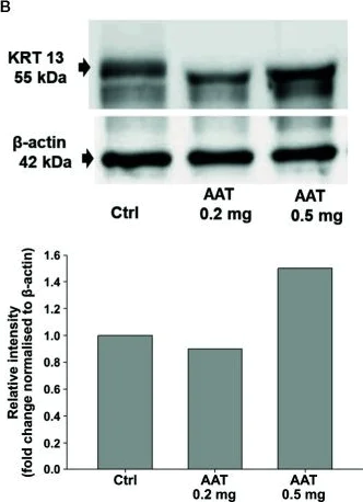 Western blot - Anti-Cytokeratin 13 antibody [EPR3671] - BSA and Azide free (AB239918)