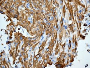 Immunohistochemistry (Formalin/PFA-fixed paraffin-embedded sections) - Anti-Cytokeratin 13 antibody [EPR3672] (AB133340), expandable thumbnail
