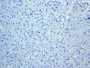 Immunohistochemistry (Formalin/PFA-fixed paraffin-embedded sections) - Anti-Cytokeratin 13 antibody [EPR3672] (AB133340), expandable thumbnail