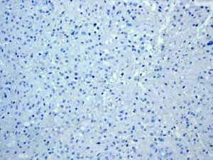 Immunohistochemistry (Formalin/PFA-fixed paraffin-embedded sections) - Anti-Cytokeratin 13 antibody [EPR3672] (AB133340)
