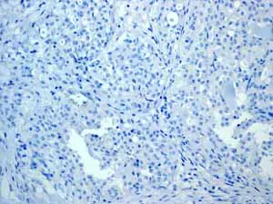 Immunohistochemistry (Formalin/PFA-fixed paraffin-embedded sections) - Anti-Cytokeratin 13 antibody [EPR3672] (AB133340)
