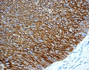 Immunohistochemistry (Formalin/PFA-fixed paraffin-embedded sections) - Anti-Cytokeratin 13 antibody [EPR3672] (AB133340)