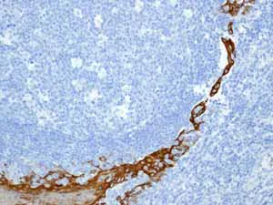 Immunohistochemistry (Formalin/PFA-fixed paraffin-embedded sections) - Anti-Cytokeratin 13 antibody [EPR3672] - BSA and Azide free (AB248486)