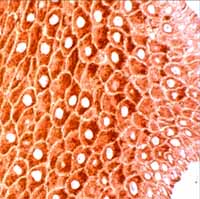 Immunohistochemistry (Formalin/PFA-fixed paraffin-embedded sections) - Anti-Cytokeratin 14 antibody (AB15461)