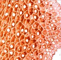 Immunohistochemistry (Formalin/PFA-fixed paraffin-embedded sections) - Anti-Cytokeratin 14 antibody (AB15461)