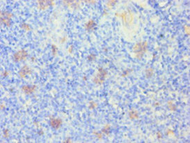 Immunohistochemistry (Formalin/PFA-fixed paraffin-embedded sections) - Anti-Cytokeratin 14 antibody (AB236258)