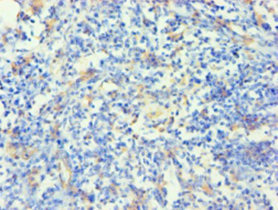 Immunohistochemistry (Formalin/PFA-fixed paraffin-embedded sections) - Anti-Cytokeratin 14 antibody (AB236258)