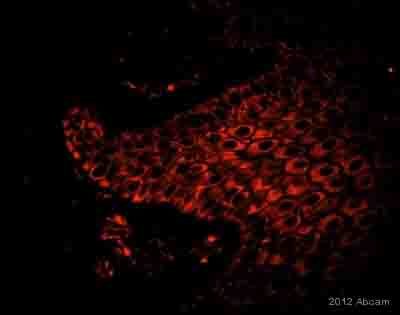 Anti-Cytokeratin 14 antibody [EP1612Y] (ab51054) | Abcam