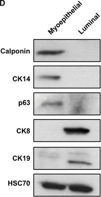 Western blot - Anti-Cytokeratin 14 antibody [EP1612Y] (ab51054), expandable thumbnail