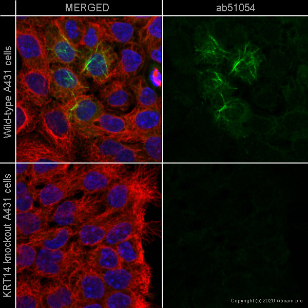 Immunocytochemistry/ Immunofluorescence - Anti-Cytokeratin 14 antibody [EP1612Y] - BSA and Azide free (AB243907), expandable thumbnail