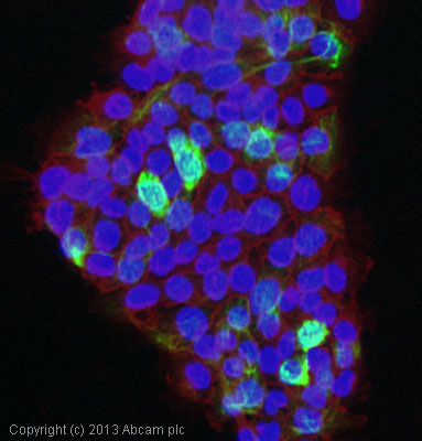 Immunocytochemistry/ Immunofluorescence - Anti-Cytokeratin 14 antibody [EP1612Y] - BSA and Azide free (AB243907), expandable thumbnail