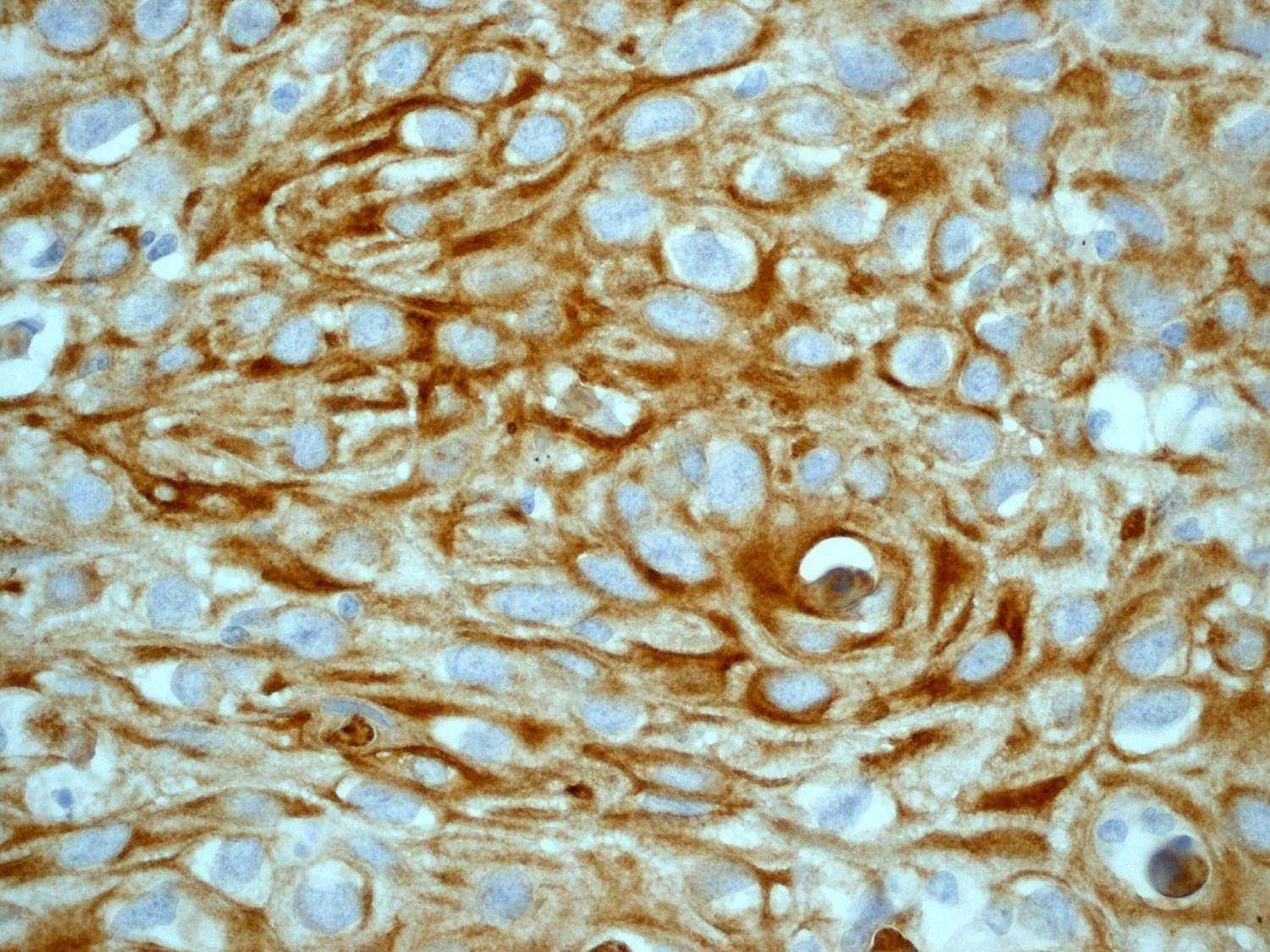 Immunohistochemistry (Formalin/PFA-fixed paraffin-embedded sections) - Anti-Cytokeratin 14 antibody [EP1612Y] - BSA and Azide free (AB243907), expandable thumbnail